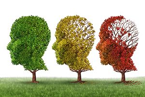 5 alzheimer's facts you probably didn't know