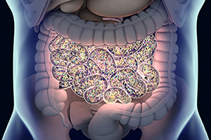 Do you have SIBO (Small Intestine Bacteria Overgrowth)?