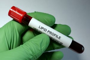 What does my elevated LDL say about my heart risk?