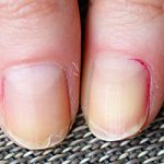 Ask Leyla: What’s causing my brittle nails?