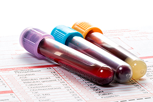 Three blood sample vials resting on a laboratory form.