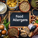 Most common allergens food shot from above. The composition includes fish, crustaceans mussels, peanut, eggs, milk soy products, bee pollen, nuts, wheat and derivates and sesame.