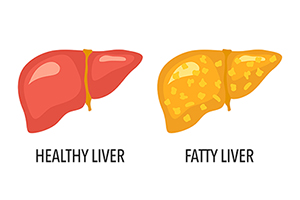 On the left, an illustration of a healthy liver with the words "healthy liver" below in black. On the right, an illustration of a fatty liver with the words "fatty liver" below in black.