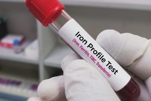 Biochemist holds blood sample for Serum Iron Profile test. Iron deficiency anemia, TIBC, Ferritin, Transferrin.