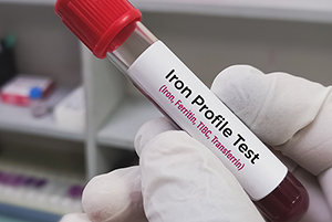 Biochemist holds blood sample for Serum Iron Profile test. Iron deficiency anemia, TIBC, Ferritin, Transferrin.