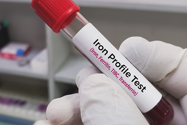 Biochemist holds blood sample for Serum Iron Profile test. Iron deficiency anemia, TIBC, Ferritin, Transferrin. 
