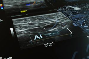 AI Medical Bot Diagnosing Breast Cancer Mammogram