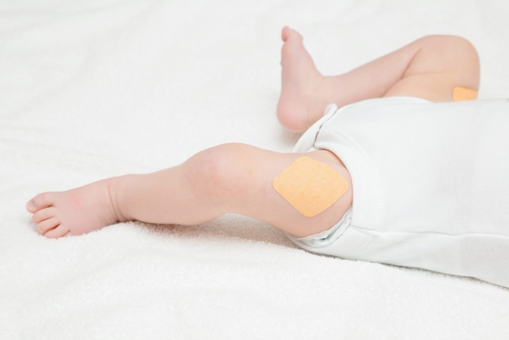 Infant with bandaids on each thigh after vaccinations