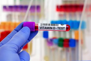 Blood sample of patient for Vitamin D test in laboratory.