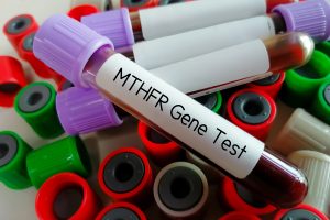 Blood sample for MTHFR gene test. Methylenetetrahydrofolate reductase