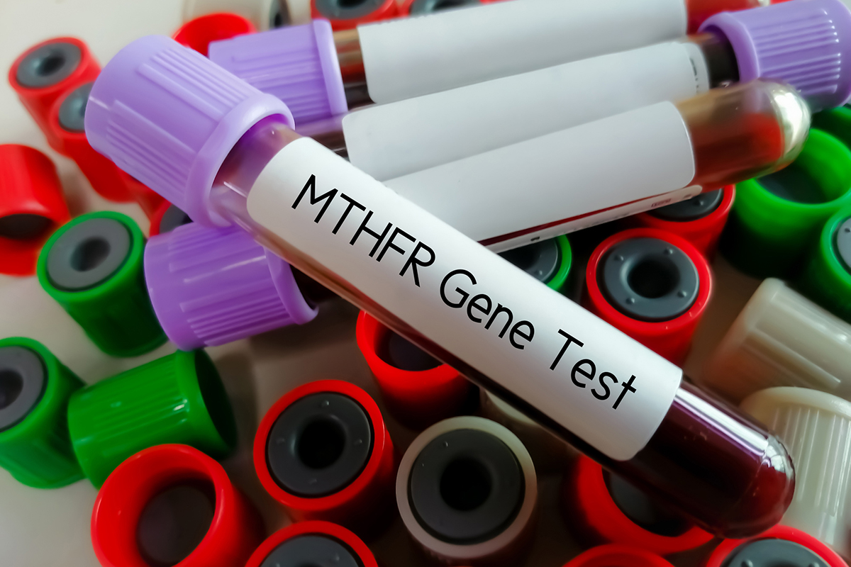 Blood sample for MTHFR gene test. Methylenetetrahydrofolate reductase